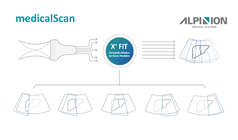 Esquema tecnología de haces ALPINION X FIT